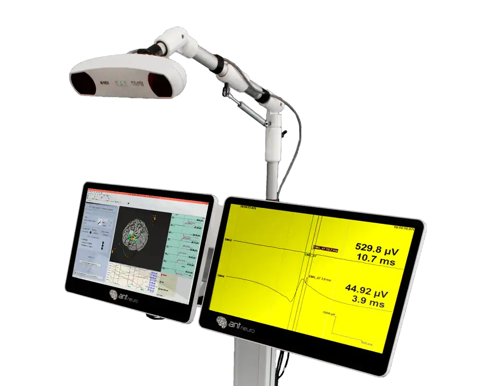 Precisión milimétrica